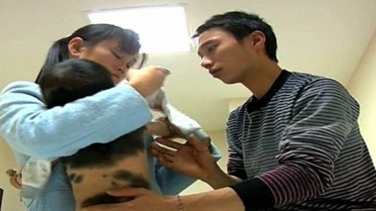 China: conmoción por un bebé que nació cubierto de pelos