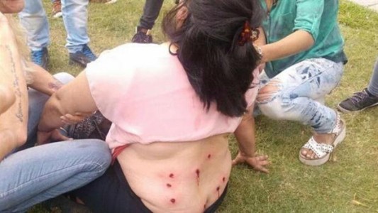Habló la mujer que recibió 9 balazos de goma en La Plata: "Yo no soy ñoqui"