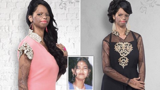 La desfiguraron con ácido y ahora es modelo de una marca de ropa