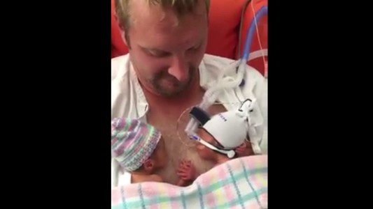 #EsViral: los gemelos prematuros que se toman de la mano