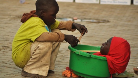La conmovedora historia de la joven que nació sin cuerpo y vive en un balde