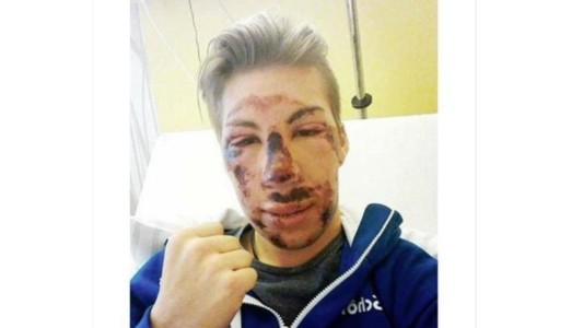 La broma de un esquiador que sufrió un duro accidente