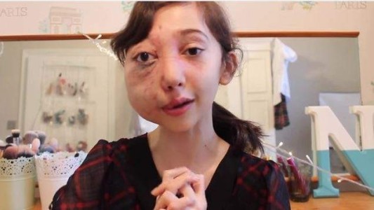 Nikki, la youtuber de 11 años que arrasa con una campaña para investigar su  enfermedad