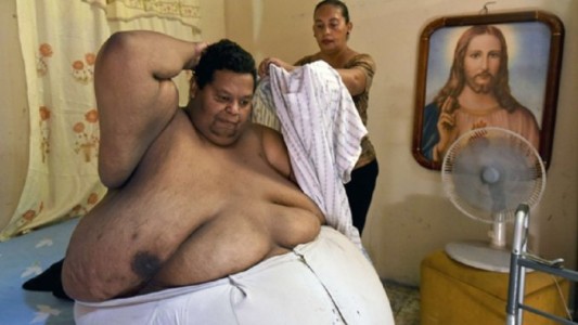 Colombia: el hombre que pesa 400 kilos cuenta cómo vive su drama