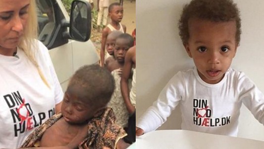 La milagrosa recuperación del nene desnutrido acusado de brujería en Nigeria