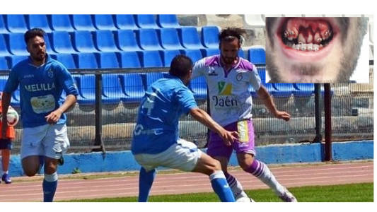 El enojo del futbolista al que le destrozaron la boca en un partido