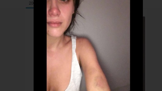 Nazarena Vélez difundió una foto de Barbie con moretones