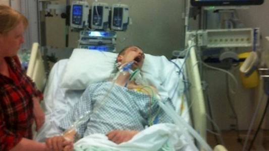 Foto impactante: la familia decidió mostrar los efectos de las "drogas legales" en un joven