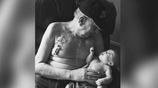 Emotiva foto de sobrevivientes: abuelo y nieto con las mismas cicatrices