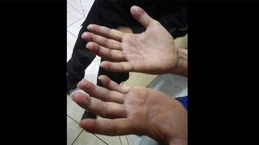 Pérez Corradi intentó borrarse todas las huellas dactilares