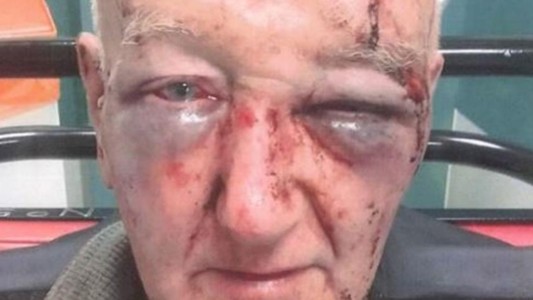 Brutal ataque a un hombre que le pidió a otro que no orine en la pared de su casa