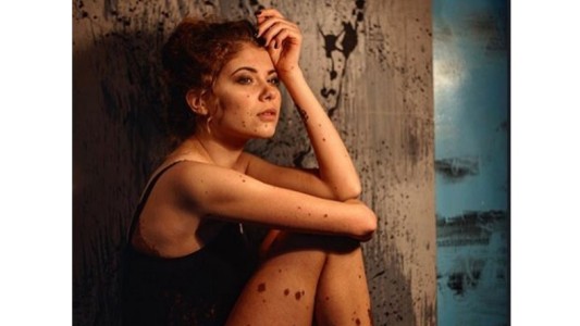 La historia de empoderamiento de la "mujer dálmata"