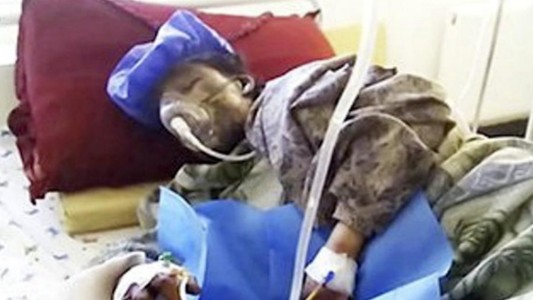 Afganistán: el padre la entregó para saldar una deuda de honor y la quemaron viva con su bebé