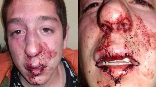 Patovicas le pegaron a un joven "por error" y ofrecieron entradas gratis como disculpas