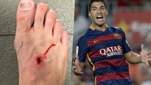 "El fútbol es para hombres", le respondió Suárez  a Filipe Luis tras la foto del pie lastimado