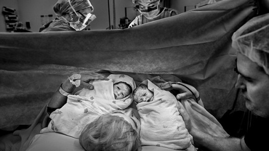 Una mujer quedó embarazada dos veces en 10 días