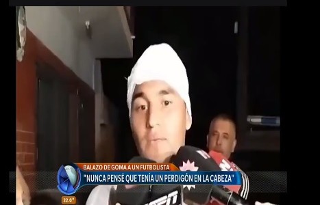 "Estuve a diez centímetros de perder mi carrera", dijo el jugador de Almagro herido con un balazo de goma