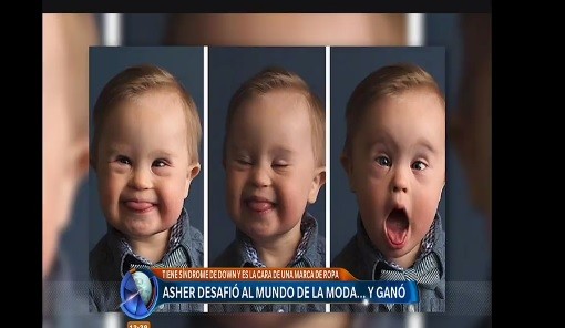 El bebé con Síndrome de Down que es modelo