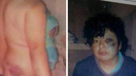 Le dieron una paliza por ser lesbiana, se defendió y está presa hace tres meses