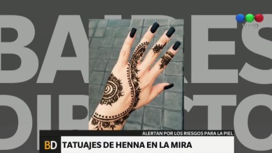 Los tatuajes de henna también pueden ser peligrosos