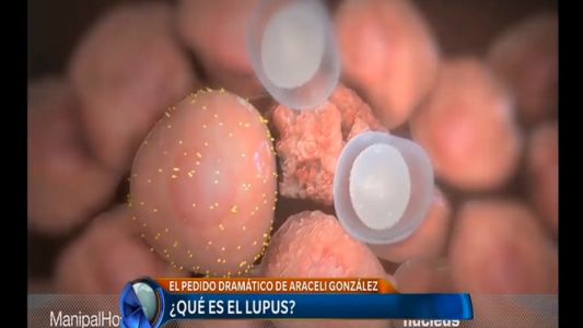 ¿Qué es el lupus?