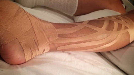 Así quedó la pierna de Paulina Rubio luego de su caída al vacío en pleno concierto