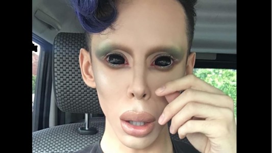 La terrible historia del joven que se hizo 110 operaciones para parecer un "marciano asexuado"