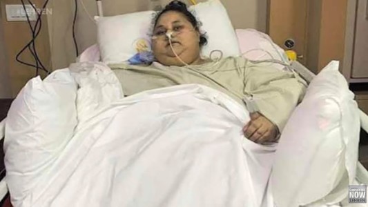 El increíble récord de la mujer más obesa del mundo: perdió 120 kilos en un mes