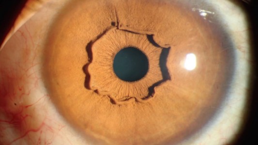 Los ojos de una mujer en China sorprenden a los especialistas