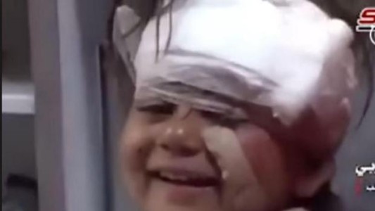 La adorable sonrisa a la cámara de una nena siria herida en el atentado en el que murieron 126 personas