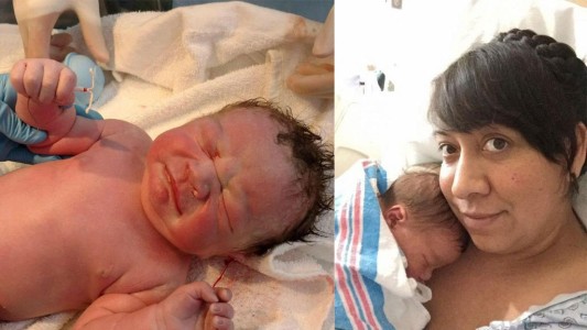 El bebé que nació con el DIU fallido entre sus manos
