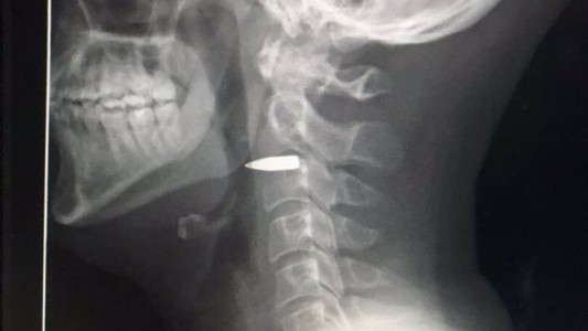 Impactante imagen de un periodista baleado