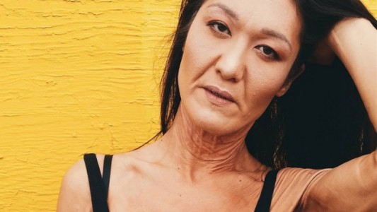 La joven modelo que sufre una rara enfermedad y esta "orgullosa" de sus arrugas