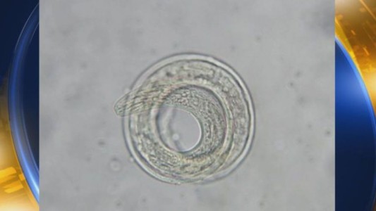 Alerta en Estados Unidos por un parásito letal que ataca el cerebro humano