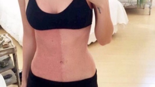 El extraño caso de la mujer que tiene su cuerpo dividido en dos colores de piel