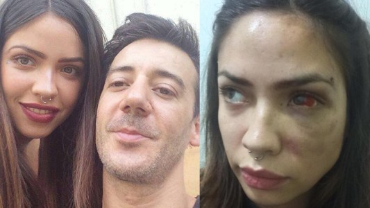 La banda Los Tetas echó al cantante luego de que su novia lo denunció por golpizas