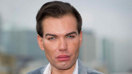 El terrible diagnóstico médico que recibió el "Ken humano"