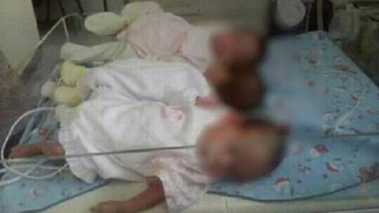 Las trillizas de San Justo volvieron con su madre y viven en un hogar sustituto