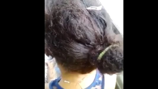 #EsViral El video de la chica con la cabeza llena de piojos que viaja en colectivo en México