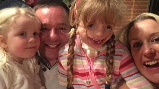 "Es una de las niñas más felices": la inspiradora historia de la nena que debió operarse 29 veces la cara