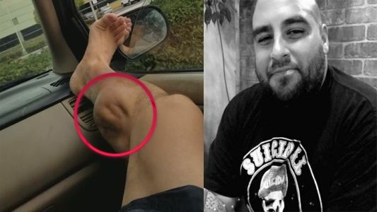 Video aterrador: el terrible calambre que sufre un hombre tras el entrenamiento