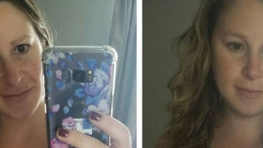 La mujer que muestra cómo le quedó la panza luego del parto