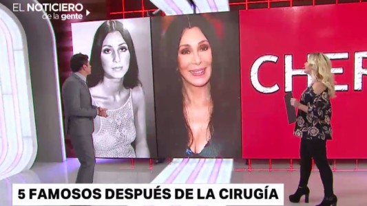 Cinco famosos después de la cirugía