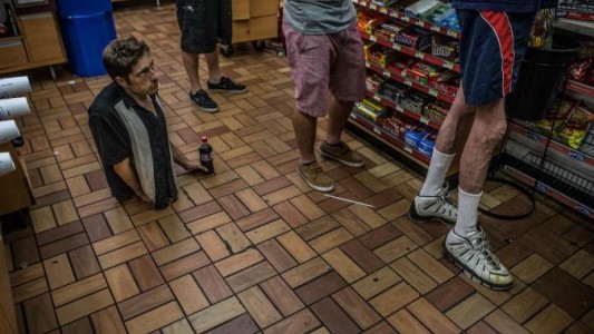 La increíble historia del hombre que tiene medio cuerpo y vive como estrella de rock