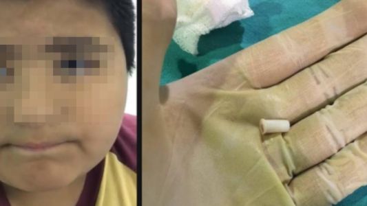 Un nene se tragó un silbato y el video se volvió viral en las redes