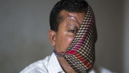 La historia del hombre al que un tigre le destrozó la cara hace más de 20 años