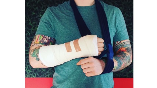 Músico quedó así tras un accidente en bicicleta y peligra su gira internacional