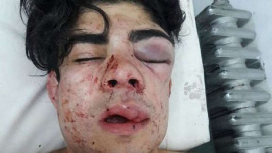 La conmovedora carta de la mamá del joven que golpearon brutalmente porque creyeron que era chileno