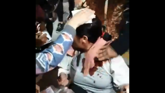 Video: una vecina protestaba pacíficamente cuando le arrojaron una botella desde un edificio