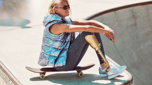 Una supermodelo perdió una pierna por un tampón y ahora podrían amputarle la otra